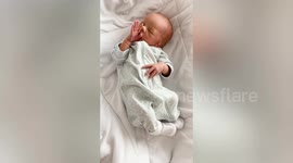 Little girl diagnosed with rare syndrome after being born without her left ear