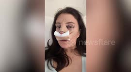 Bride has £1.1k eyelid surgery for wedding - and says it's