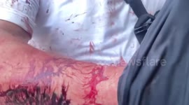 British chip shop boss, 39, found wandering along beach covered in blood in Thai 'Sin City' Pattaya