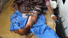 8-year-old Palestinian girl suffers amputations after Israeli strike on tent