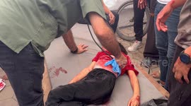 The arrival of a child martyr who was revived but died inside the Baptist Hospital