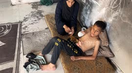 Palestinian teen who lost arm in Gaza airstrike dreams of playing football again