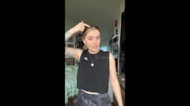 Woman has 3 cysts removed from her scalp and documents the procedure