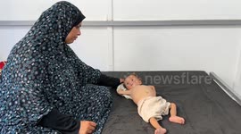Child malnutrition rises in Nuseirat Camp amid Israel's Gaza blockade (2)