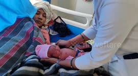 Rare birth stirs emotions as mother gives birth to healthy baby girl born without arms