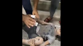 Gaza Strip - Children Injured Following an Airstrike in Gaza city