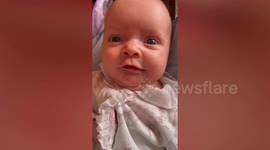 Mum fears people will mistake tot's rare skin condition for