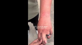 American tourists tell how they fought off muggers in Barcelona