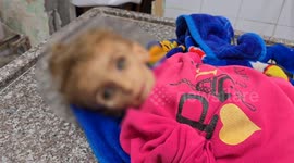 Palestinian toddler dies of malnutrition amid Gaza shortages