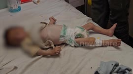 Gaza baby dies of starvation amid Israel’s deadly blockade