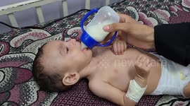Gaza’s starving infants fight for life amid Israel’s ruthless siege and attacks (2)