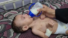Gaza’s starving infants fight for life amid Israel’s ruthless siege and attacks (2)
