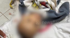 Another Palestinian infant dies from malnutrition in Gaza due to Israeli blockade (2)