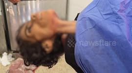10-year-old girl dies of malnutrition amid ongoing blockade in Gaza