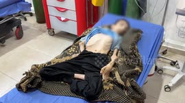 ‘He died in front of us’: Gaza family mourns son lost to starvation amid growing famine