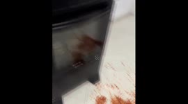 Sauce spills during cooking mishap in Duque de Caxias, Rio de Janeiro