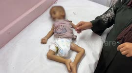 Another Palestinian baby dies of severe malnutrition in Gaza due to Israeli siege