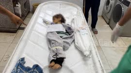 Another Palestinian infant dies of severe malnutrition in Gaza due to Israeli siege