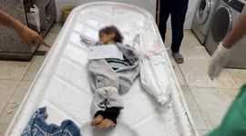 Another Palestinian infant dies of severe malnutrition in Gaza due to Israeli siege