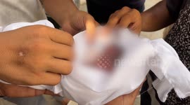 Unborn baby killed in Israeli strike on Gaza’s Zaytoun neighborhood