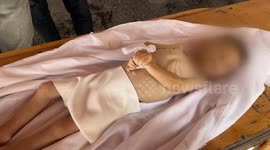 Starvation claims another toddler’s life in Gaza Strip under Israeli siege