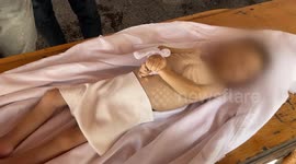 Starvation claims another toddler’s life in Gaza Strip under Israeli siege