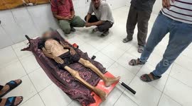 Elderly Palestinian dies of malnutrition in Gaza Strip