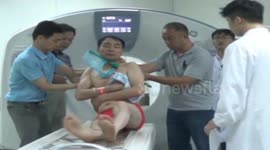 Doctors remove broom from man's chest