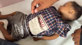 Five-year-old Palestinian boy dies of malnutrition in Gaza