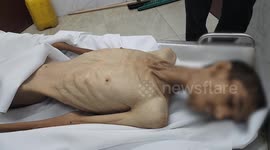 Another Palestinian dies from Israel-induced starvation in besieged Gaza