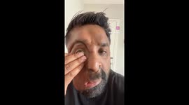 Breaking the stigma: Viral prosthetic eye video sparks global conversation on NF1