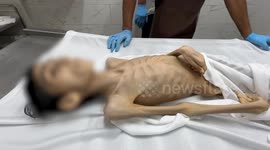 Mozambique: Palestinian teen with cerebral palsy dies of malnutrition in Gaza as famine worsens