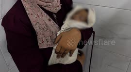 Two-month-old baby dies in Gaza due to malnutrition