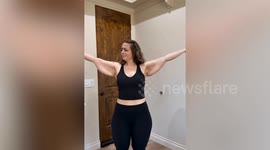 Woman lost 200lbs after struggling at Disneyland and has 15lbs of skin removed