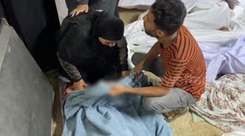 28-year-old Palestinian man dies of malnutrition in blockaded Gaza