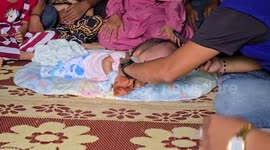 Baby with rare swollen head condition receives aid from authorities