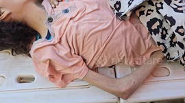 One more child dies of hunger in Gaza under Israeli blockade