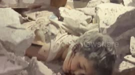 Severely injured Palestinian child pulled out from rubble after Israeli strike in Gaza