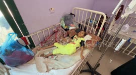 Starvation crisis deepens in Gaza, 10-year-old girl battles malnutrition