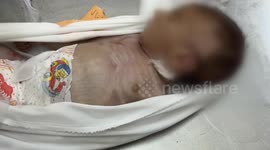 Palestinian infant dies of malnutrition as Gaza famine toll rises