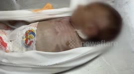Palestinian infant dies of malnutrition as Gaza famine toll rises