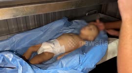Palestinian child dies of malnutrition in Gaza amid Israeli blockade