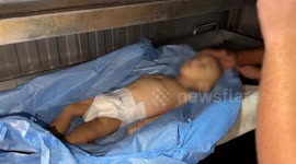 Palestinian child dies of malnutrition in Gaza amid Israeli blockade