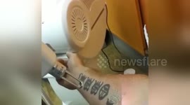 Newsflare Edit - Tattoo laser removal