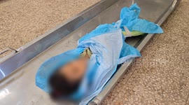 10-year-old girl dies of malnutrition in Gaza under Israeli blockage