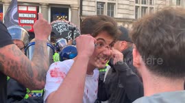 A man is covered in blood after being hit by police at the Unite the Kingdom far right rally in London