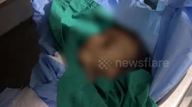 Gaza death toll from hunger rises to 428 as UN commission of inquiry states Israel is committing genocide