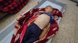 17 killed in Israeli strikes on Gaza as eight-year-old boy dies of malnutrition