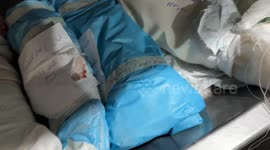 13 babies die in a single day at Nasser Hospital in southern Gaza