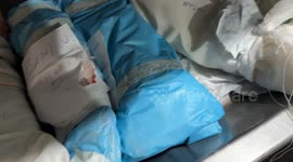 13 babies die in a single day at Nasser Hospital in southern Gaza